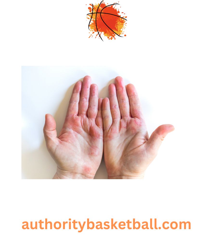 why basketball players use chalk - blister prevention